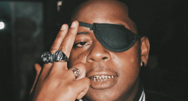 A person wearing a black eye patch and rings on their fingers holds two fingers up near their face, showing gold teeth—a signature look for Hip-Hop and Amapiano Artists like SSG’98.